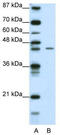 Zinc Finger Protein 17 antibody, TA343649, Origene, Western Blot image 
