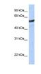 Malic Enzyme 3 antibody, NBP1-54755, Novus Biologicals, Western Blot image 