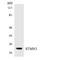 Stathmin 3 antibody, LS-C200736, Lifespan Biosciences, Western Blot image 