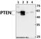 Phosphatase And Tensin Homolog antibody, A00006Y379, Boster Biological Technology, Western Blot image 