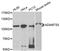 ADAM Metallopeptidase With Thrombospondin Type 1 Motif 5 antibody, A2836, ABclonal Technology, Western Blot image 