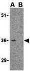 C1q And TNF Related 3 antibody, GTX85505, GeneTex, Western Blot image 