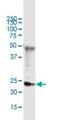 DNA Damage Inducible Transcript 4 Like antibody, H00115265-M01, Novus Biologicals, Immunoprecipitation image 