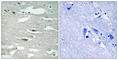 Integrin Linked Kinase antibody, abx012602, Abbexa, Western Blot image 