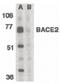 Beta-Secretase 2 antibody, PA5-19951, Invitrogen Antibodies, Western Blot image 