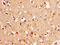 Thiopurine S-Methyltransferase antibody, CSB-PA00585A0Rb, Cusabio, Immunohistochemistry paraffin image 