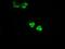 Glucokinase antibody, GTX84440, GeneTex, Immunofluorescence image 