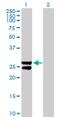 Metabolism Of Cobalamin Associated B antibody, H00326625-B02P, Novus Biologicals, Western Blot image 