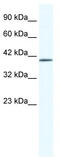 Zinc Finger Protein 322 antibody, TA341393, Origene, Western Blot image 