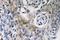 CD63 Molecule antibody, LS-C177538, Lifespan Biosciences, Immunohistochemistry paraffin image 