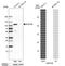 DNA Methyltransferase 3 Beta antibody, HPA001595, Atlas Antibodies, Western Blot image 