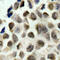 Histone Deacetylase 8 antibody, abx000408, Abbexa, Immunohistochemistry paraffin image 