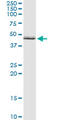 Aldehyde Dehydrogenase 3 Family Member B1 antibody, LS-C196642, Lifespan Biosciences, Immunoprecipitation image 
