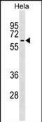 Kelch Like Family Member 12 antibody, PA5-71995, Invitrogen Antibodies, Western Blot image 