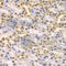 Lysine Demethylase 1A antibody, A1156, ABclonal Technology, Immunohistochemistry paraffin image 