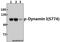Dynamin 1 antibody, A02536S774, Boster Biological Technology, Western Blot image 