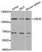 Cbl Proto-Oncogene B antibody, PA5-76651, Invitrogen Antibodies, Western Blot image 