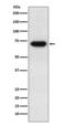 Ectonucleoside Triphosphate Diphosphohydrolase 1 antibody, M03196-2, Boster Biological Technology, Western Blot image 