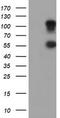 Serine Peptidase Inhibitor, Kunitz Type 1 antibody, TA504605, Origene, Western Blot image 