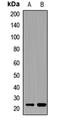 Nitric Oxide Synthase Interacting Protein antibody, LS-C668753, Lifespan Biosciences, Western Blot image 