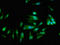 Staphylococcal Nuclease And Tudor Domain Containing 1 antibody, LS-C669584, Lifespan Biosciences, Immunofluorescence image 