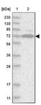 Germ Cell Nuclear Acidic Peptidase antibody, NBP1-85993, Novus Biologicals, Western Blot image 