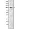 Inositol Polyphosphate-4-Phosphatase Type I A antibody, abx216242, Abbexa, Western Blot image 