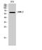 LIM Domain Kinase 2 antibody, STJ93930, St John