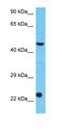 F-Box And Leucine Rich Repeat Protein 12 antibody, orb331041, Biorbyt, Western Blot image 
