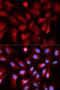 Hypoxia Inducible Factor 1 Subunit Alpha Inhibitor antibody, LS-C334077, Lifespan Biosciences, Immunofluorescence image 