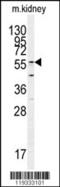 Glutamate Decarboxylase Like 1 antibody, 62-289, ProSci, Western Blot image 