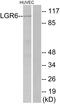 Leucine-rich repeat-containing G-protein coupled receptor 6 antibody, LS-C120734, Lifespan Biosciences, Western Blot image 