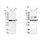 Hydroxyacyl-CoA Dehydrogenase Trifunctional Multienzyme Complex Subunit Beta antibody, NBP2-38353, Novus Biologicals, Western Blot image 