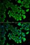 Microtubule Associated Protein 1 Light Chain 3 Alpha antibody, LS-C334175, Lifespan Biosciences, Immunofluorescence image 