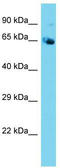 NPL4 Homolog, Ubiquitin Recognition Factor antibody, TA343206, Origene, Western Blot image 