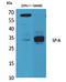 Surfactant Protein A2 antibody, STJ96556, St John