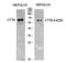 Cortactin antibody, STJ97234, St John