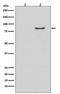 Lipase E, Hormone Sensitive Type antibody, P06762-1, Boster Biological Technology, Western Blot image 