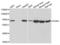 Phosphoglucomutase 1 antibody, LS-C334625, Lifespan Biosciences, Western Blot image 