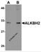 AlkB Homolog 2, Alpha-Ketoglutarate Dependent Dioxygenase antibody, 5871, ProSci, Western Blot image 