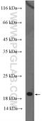 Retinoic Acid Receptor Responder 2 antibody, 10216-1-AP, Proteintech Group, Western Blot image 