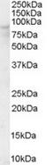 Oxysterol-binding protein 1 antibody, TA303012, Origene, Western Blot image 