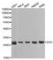 Eukaryotic Translation Initiation Factor 6 antibody, STJ23523, St John