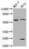 Solute Carrier Family 45 Member 2 antibody, LS-C681372, Lifespan Biosciences, Western Blot image 