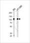 ATPase Sarcoplasmic/Endoplasmic Reticulum Ca2+ Transporting 1 antibody, 61-704, ProSci, Western Blot image 