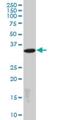 Laforin antibody, H00007957-M01, Novus Biologicals, Western Blot image 