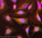 Sphingomyelin Phosphodiesterase 1 antibody, ab83354, Abcam, Immunofluorescence image 