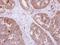 DIS3 Like 3'-5' Exoribonuclease 2 antibody, GTX118786, GeneTex, Immunohistochemistry paraffin image 