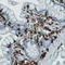 CD45 antibody, AMAb90518, Atlas Antibodies, Immunohistochemistry paraffin image 