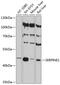 Serpin Family E Member 1 antibody, 14-262, ProSci, Western Blot image 